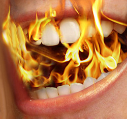 Burning Mouth Syndrome