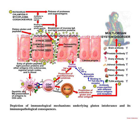 Digestion